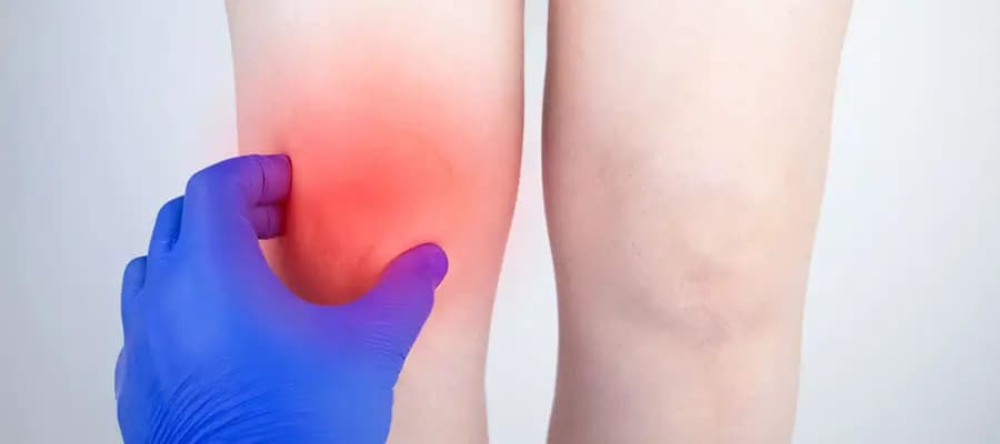 Menisküs Yırtılması Belirtileri ve Tedavisi