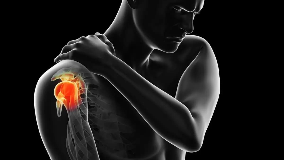 Omuz Sıkışması Tedavisi Nedir? Nasıl Yapılır?