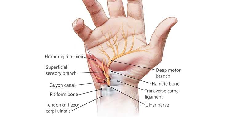 Flexor Tendon Yaralanmaları