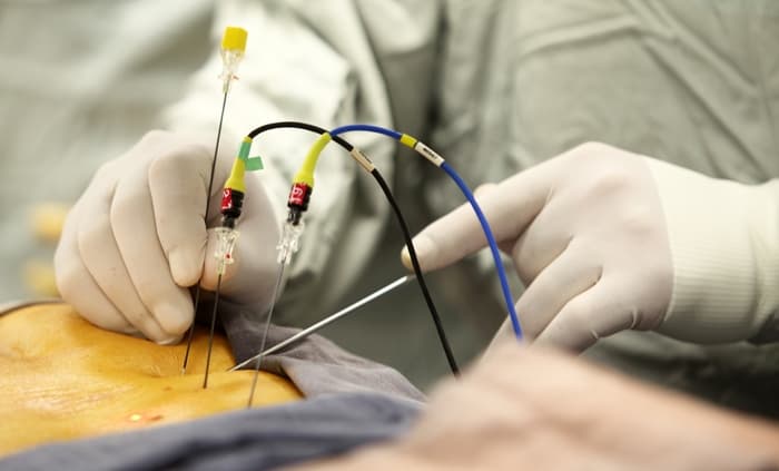 Ameliyatsız Bel Fıtığı Tedavisi