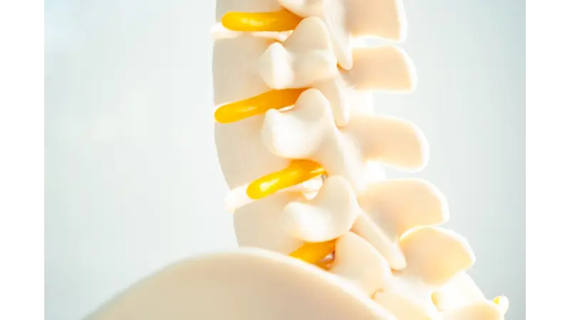 What is Lumbar Hernia?