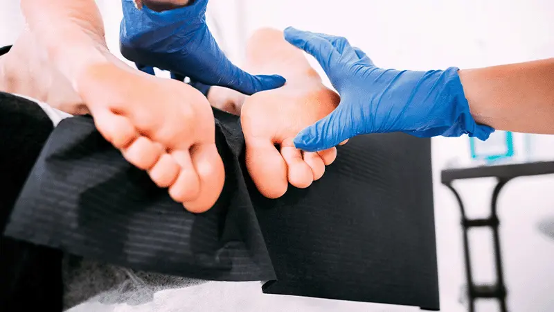 Ayak Deformiteleri Neden Olur? Belirtileri Nelerdir?