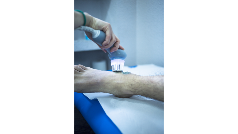 Reviews From Patients Who Underwent Shock Wave Therapy