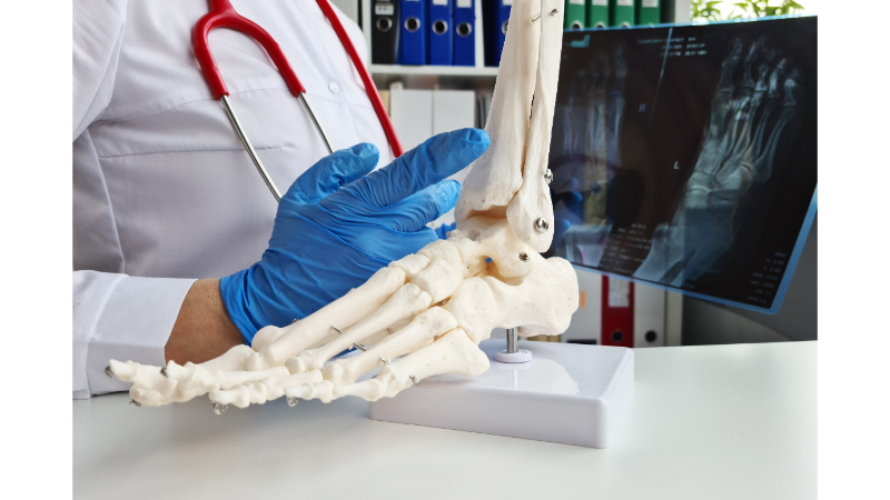 What Are the Symptoms of Bone Marrow Edema?