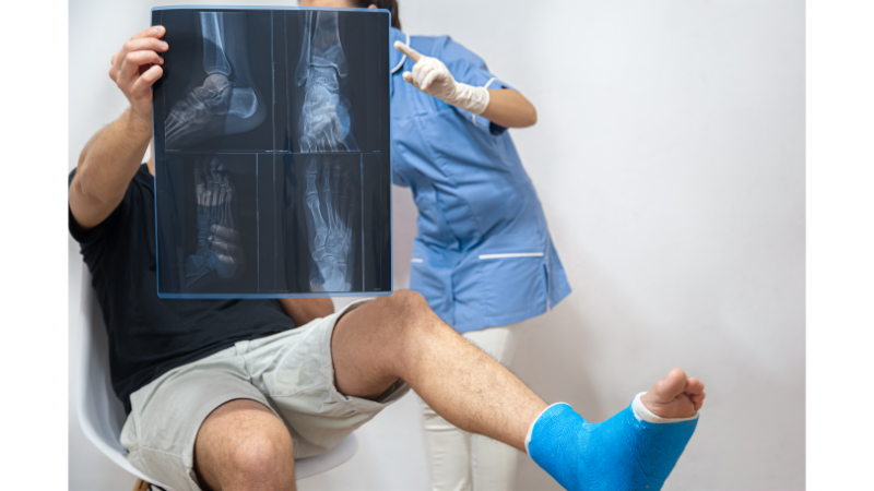 Ayak Bileği Kırığı Sonrası Fizik Tedavi ve Egzersizler